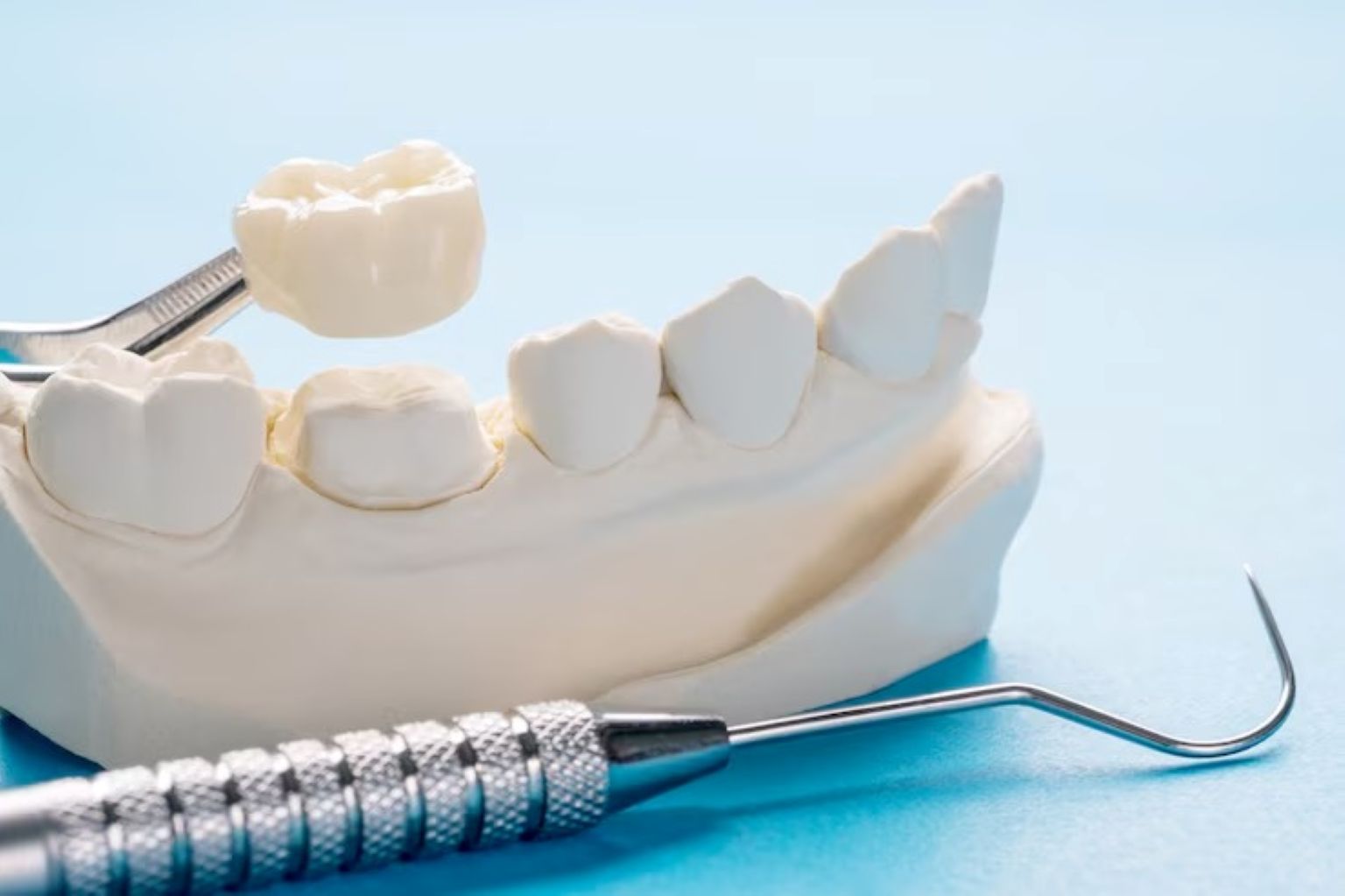 What Are Dental Crowns Used For? 7 Common Reasons You Might Need One